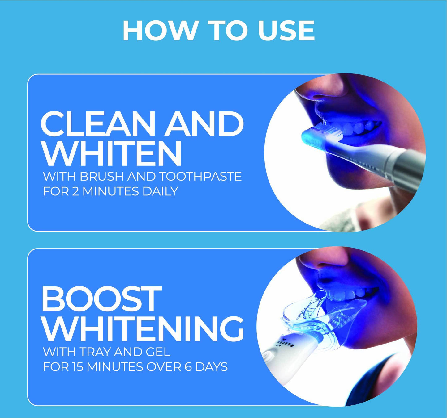 STYLSMILE Ultimate Whitening Kit